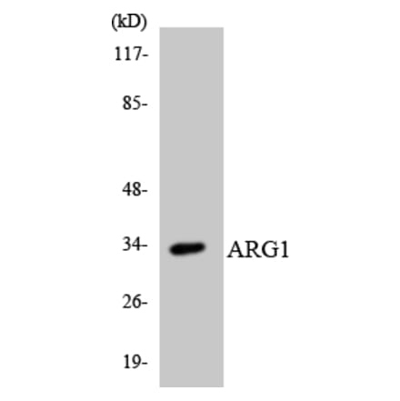 Western Blot - Anti-ARG1 Antibody (R12-2501) - Antibodies.com