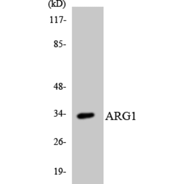 Western Blot - Anti-ARG1 Antibody (R12-2501) - Antibodies.com