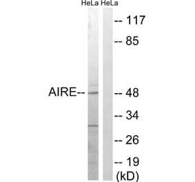 Western Blot - Anti-AIRE Antibody (B8286) - Antibodies.com