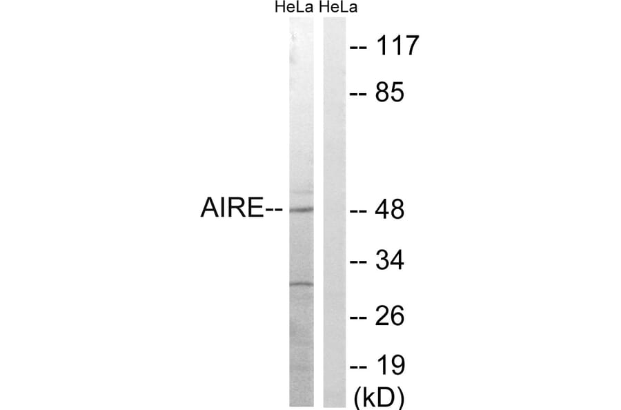 Western Blot - Anti-AIRE Antibody (B8286) - Antibodies.com