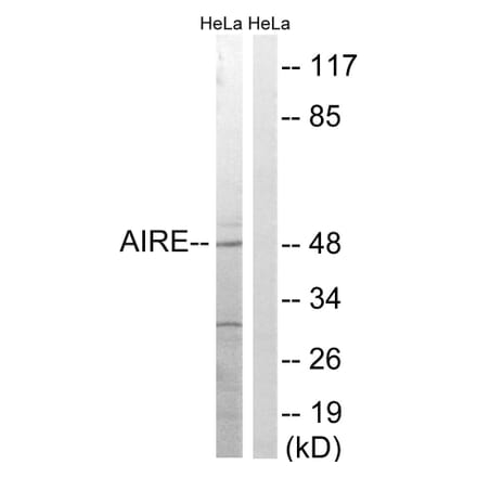 Western Blot - Anti-AIRE Antibody (B8286) - Antibodies.com