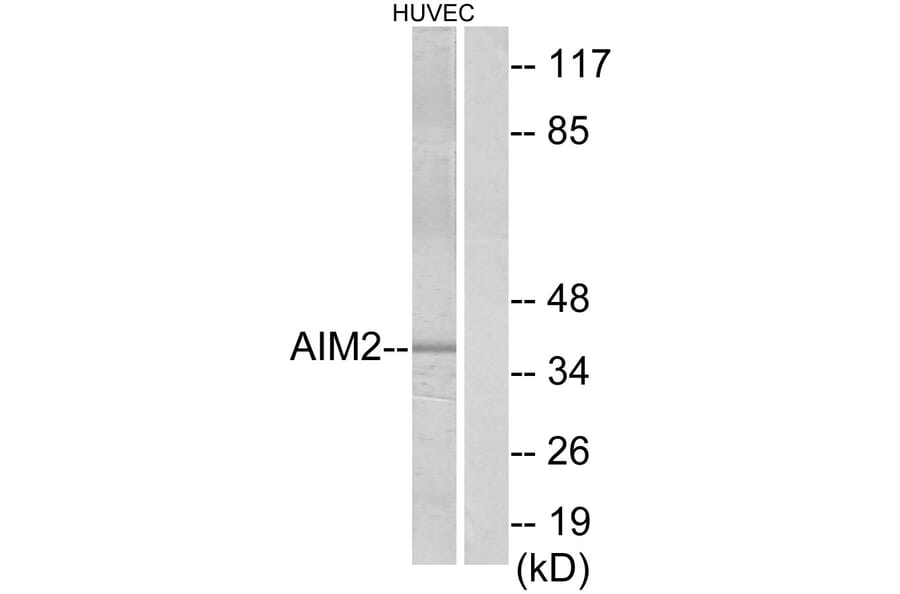 Western Blot - Anti-AIM2 Antibody (C12049) - Antibodies.com