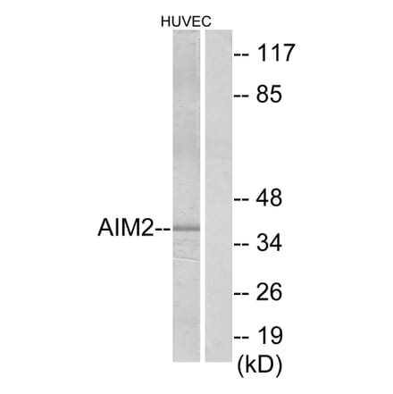 Western Blot - Anti-AIM2 Antibody (C12049) - Antibodies.com