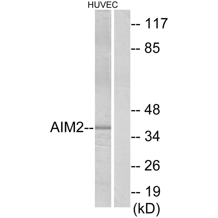 Western Blot - Anti-AIM2 Antibody (C12049) - Antibodies.com