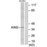 Western Blot - Anti-AIM2 Antibody (C12049) - Antibodies.com