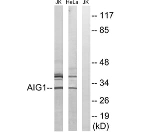 Western Blot - Anti-AIG1 Antibody (C14468) - Antibodies.com