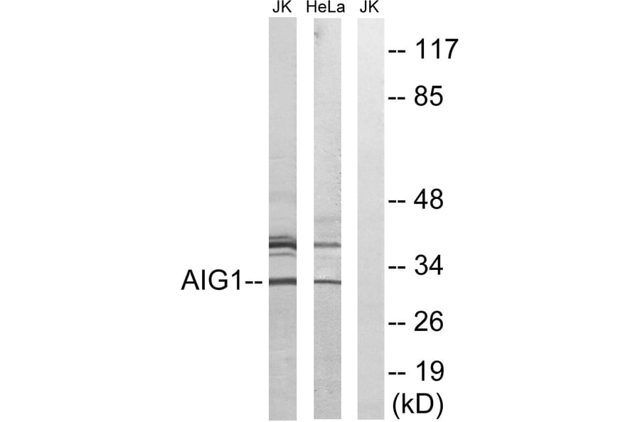 Western Blot - Anti-AIG1 Antibody (C14468) - Antibodies.com