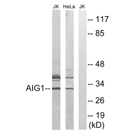 Western Blot - Anti-AIG1 Antibody (C14468) - Antibodies.com