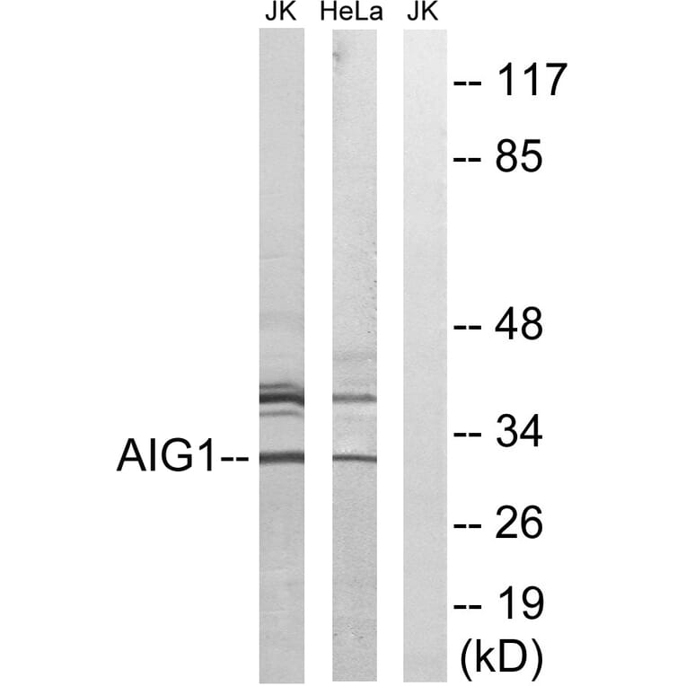 Western Blot - Anti-AIG1 Antibody (C14468) - Antibodies.com