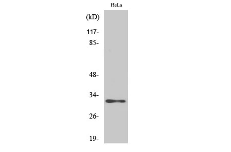 Western Blot - Anti-AIG1 Antibody (C14468) - Antibodies.com