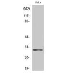Western Blot - Anti-AIG1 Antibody (C14468) - Antibodies.com