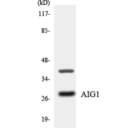 Western Blot - Anti-AIG1 Antibody (R12-2468) - Antibodies.com