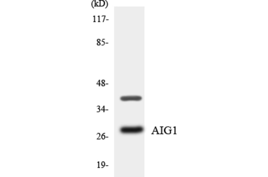 Western Blot - Anti-AIG1 Antibody (R12-2468) - Antibodies.com