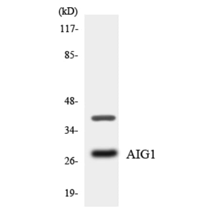 Western Blot - Anti-AIG1 Antibody (R12-2468) - Antibodies.com