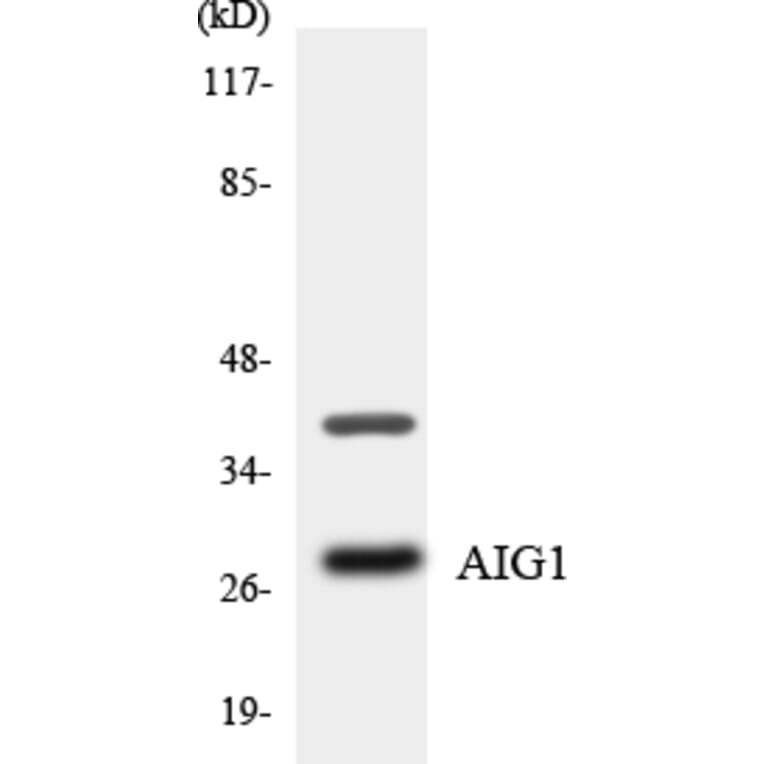 Western Blot - Anti-AIG1 Antibody (R12-2468) - Antibodies.com