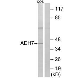 Western Blot - Anti-ADH7 Antibody (C14383) - Antibodies.com