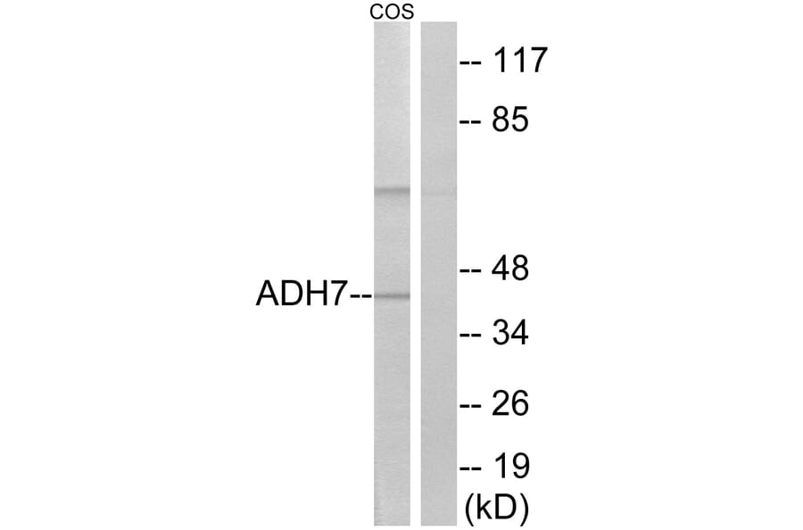 Western Blot - Anti-ADH7 Antibody (C14383) - Antibodies.com