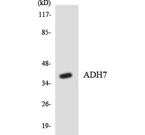 Western Blot - Anti-ADH7 Antibody (R12-2450) - Antibodies.com