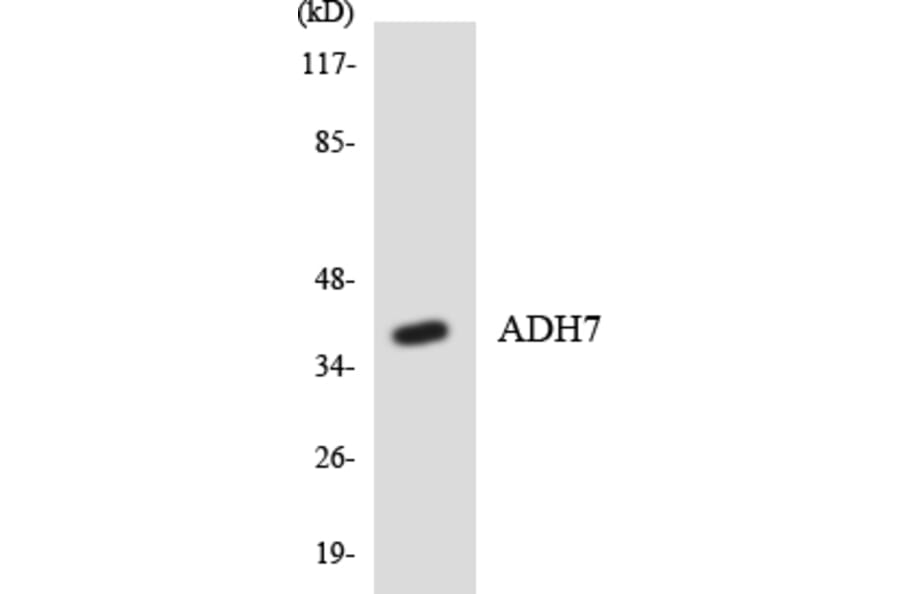 Western Blot - Anti-ADH7 Antibody (R12-2450) - Antibodies.com