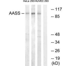 Western Blot - Anti-AASS Antibody (C14422) - Antibodies.com