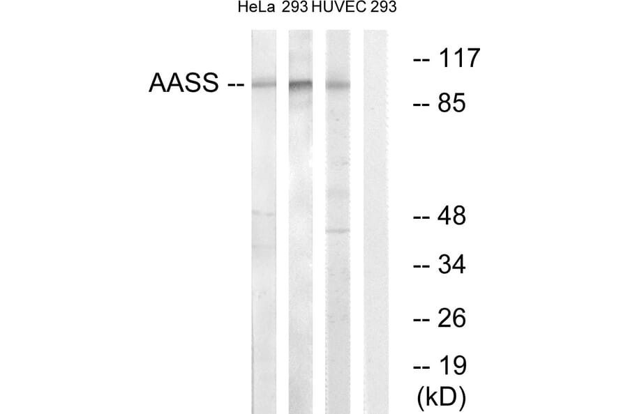 Western Blot - Anti-AASS Antibody (C14422) - Antibodies.com