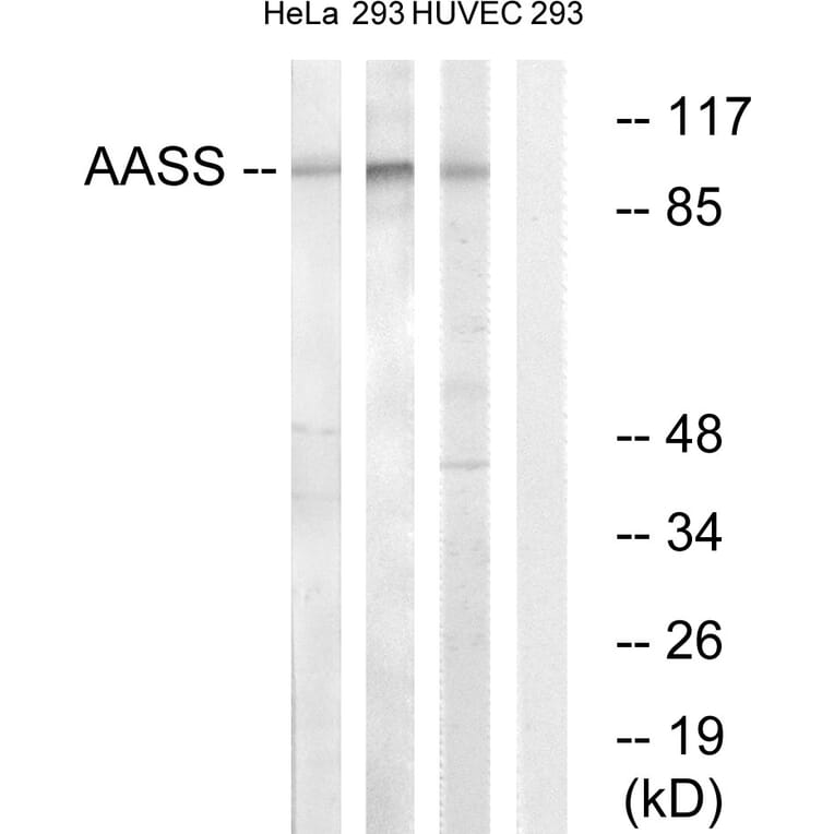Western Blot - Anti-AASS Antibody (C14422) - Antibodies.com