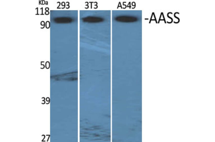 Western Blot - Anti-AASS Antibody (C14422) - Antibodies.com