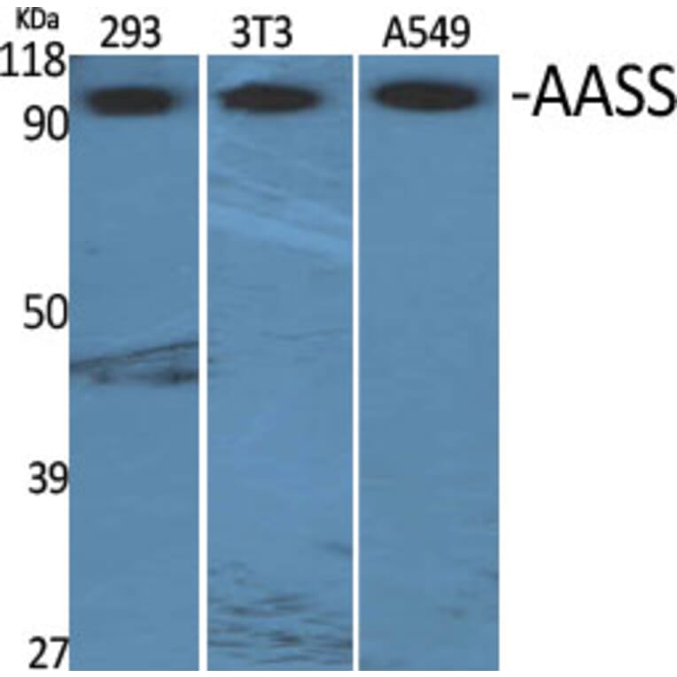 Western Blot - Anti-AASS Antibody (C14422) - Antibodies.com