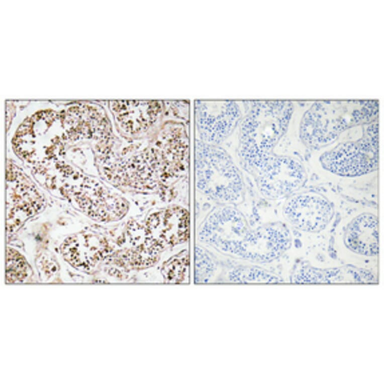 Immunohistochemistry - Anti-VIP Antibody (R12-2412) - Antibodies.com