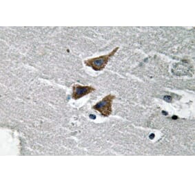 Immunohistochemistry - Anti-uPA Antibody (R12-2403) - Antibodies.com