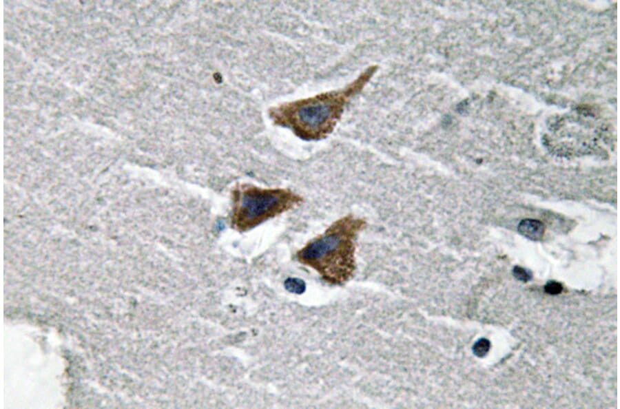 Immunohistochemistry - Anti-uPA Antibody (R12-2403) - Antibodies.com