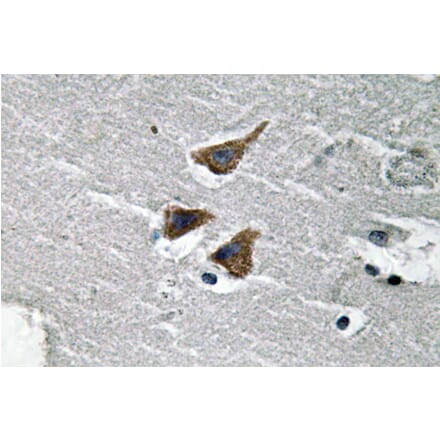 Immunohistochemistry - Anti-uPA Antibody (R12-2403) - Antibodies.com