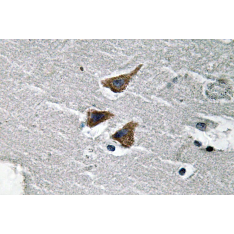 Immunohistochemistry - Anti-uPA Antibody (R12-2403) - Antibodies.com