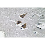 Immunohistochemistry - Anti-uPA Antibody (R12-2403) - Antibodies.com