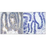 Immunohistochemistry - Anti-PKR Antibody (B7199) - Antibodies.com