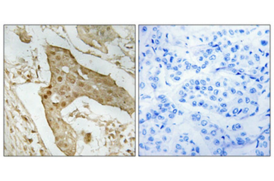 Immunohistochemistry - Anti-p53 Antibody (B8053) - Antibodies.com