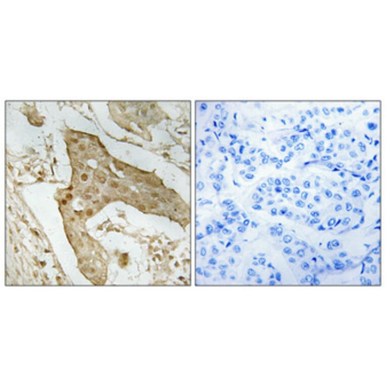 Immunohistochemistry - Anti-p53 Antibody (B8053) - Antibodies.com