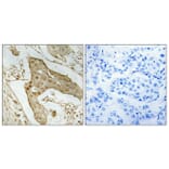 Immunohistochemistry - Anti-p53 Antibody (B8053) - Antibodies.com