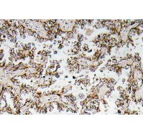 Immunohistochemistry - Anti-CRF Antibody (R12-2103) - Antibodies.com