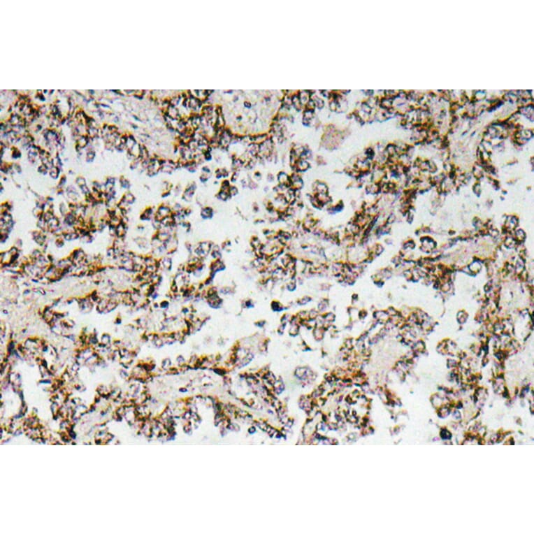 Immunohistochemistry - Anti-CRF Antibody (R12-2103) - Antibodies.com