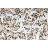 Immunohistochemistry - Anti-CRF Antibody (R12-2103) - Antibodies.com