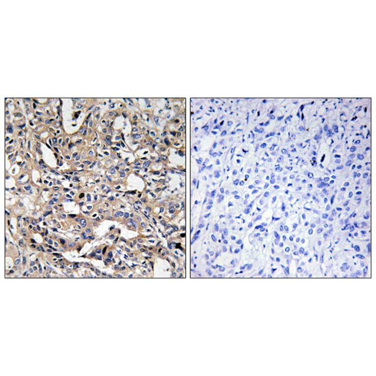Immunohistochemistry - Anti-BAX Antibody (C13028) - Antibodies.com