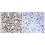 Immunohistochemistry - Anti-BAX Antibody (C13028) - Antibodies.com
