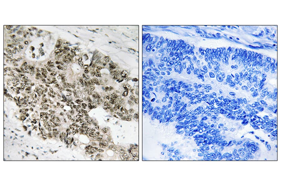 Immunohistochemistry - Anti-ATR Antibody (B8270) - Antibodies.com