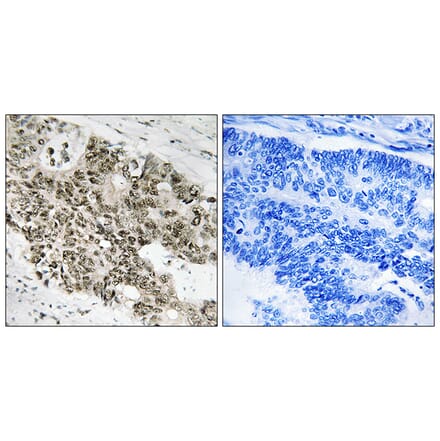 Immunohistochemistry - Anti-ATR Antibody (B8270) - Antibodies.com