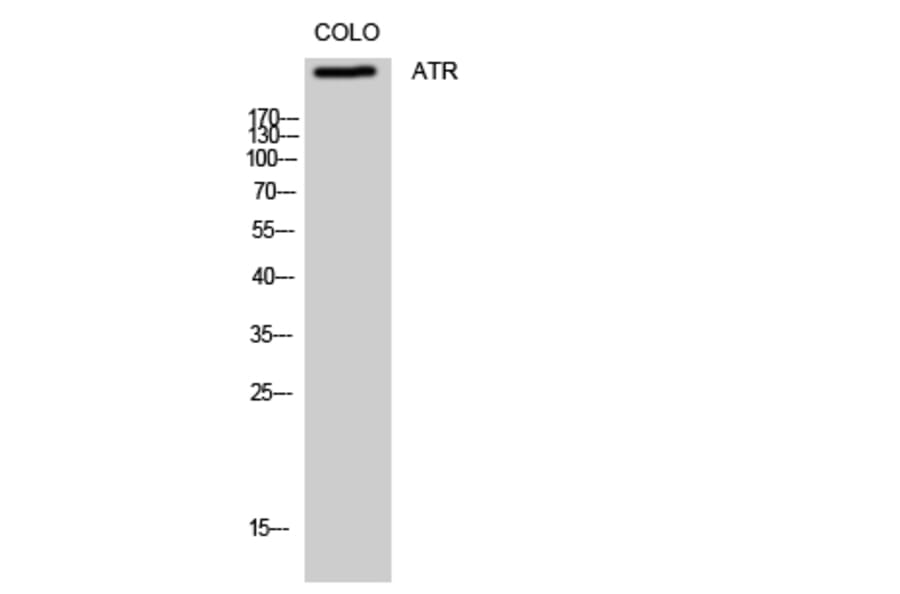 Western Blot - Anti-ATR Antibody (B8270) - Antibodies.com