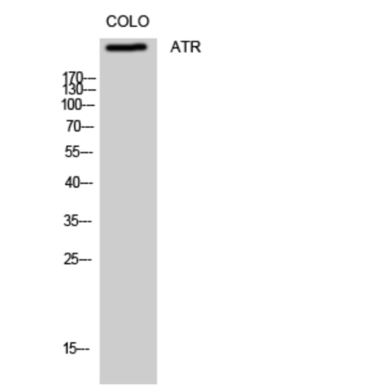 Western Blot - Anti-ATR Antibody (B8270) - Antibodies.com