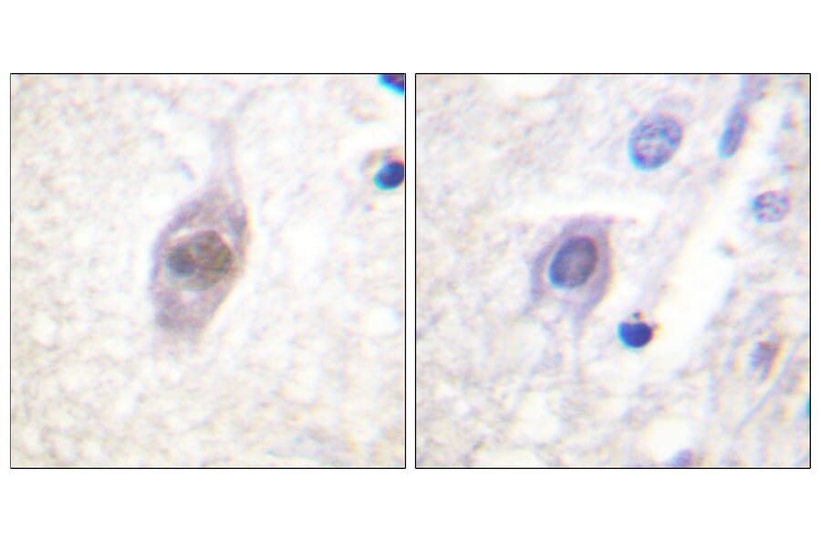 Immunohistochemistry - Anti-APC Antibody (B0818) - Antibodies.com