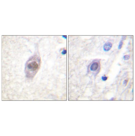 Immunohistochemistry - Anti-APC Antibody (B0818) - Antibodies.com