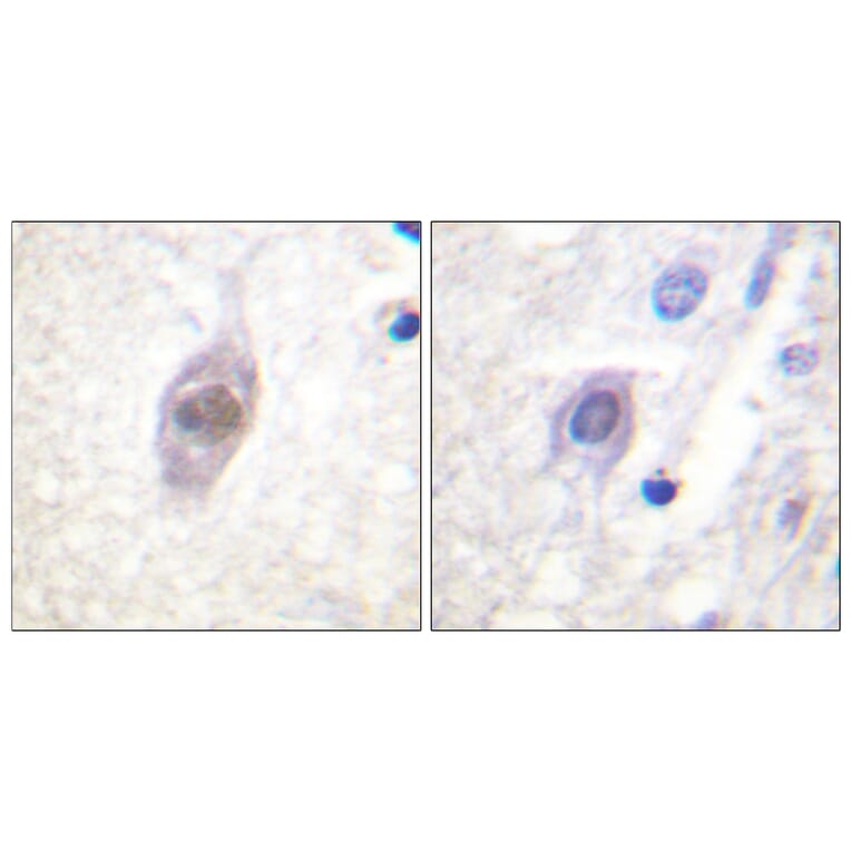 Immunohistochemistry - Anti-APC Antibody (B0818) - Antibodies.com